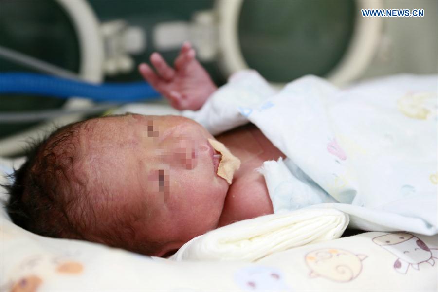 CHINA-SHAANXI-XI'AN-TRANSPLANTED WOMB-BABY-BIRTH (CN)